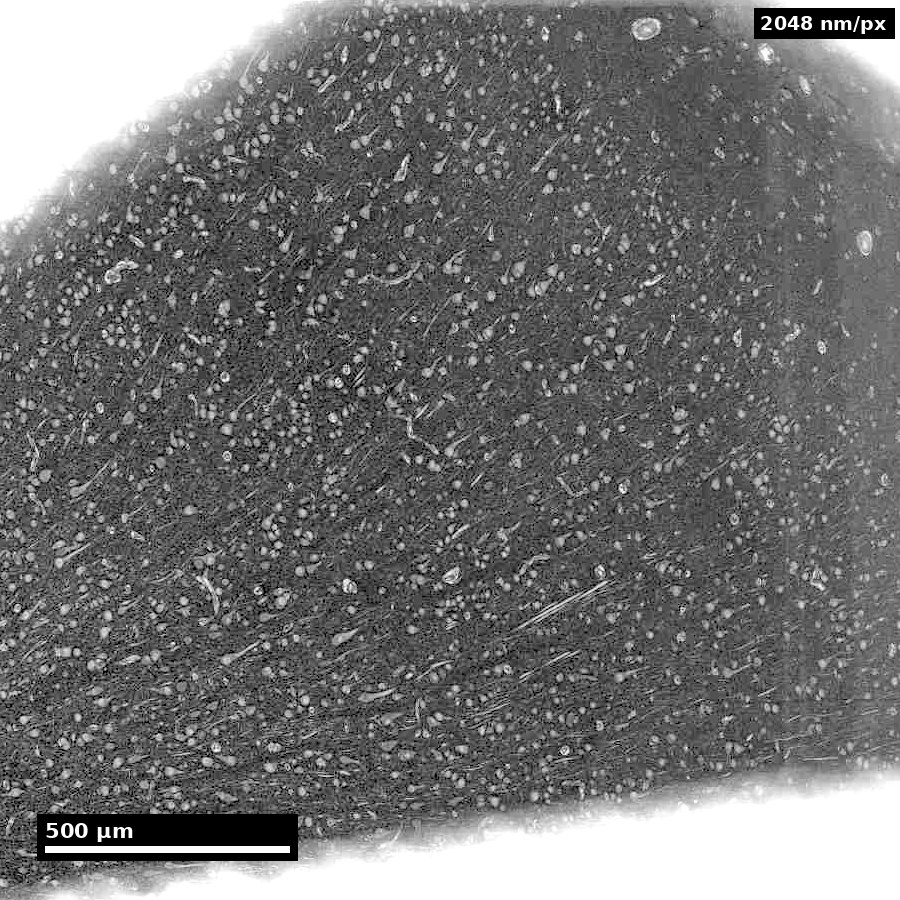 A 1.8-millimetre-wide field of H01 cortex showing the pial surface and thousands of cell bodies as small pale dots.
