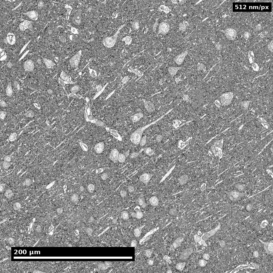 ≈460 µm — cell bodies and vessels