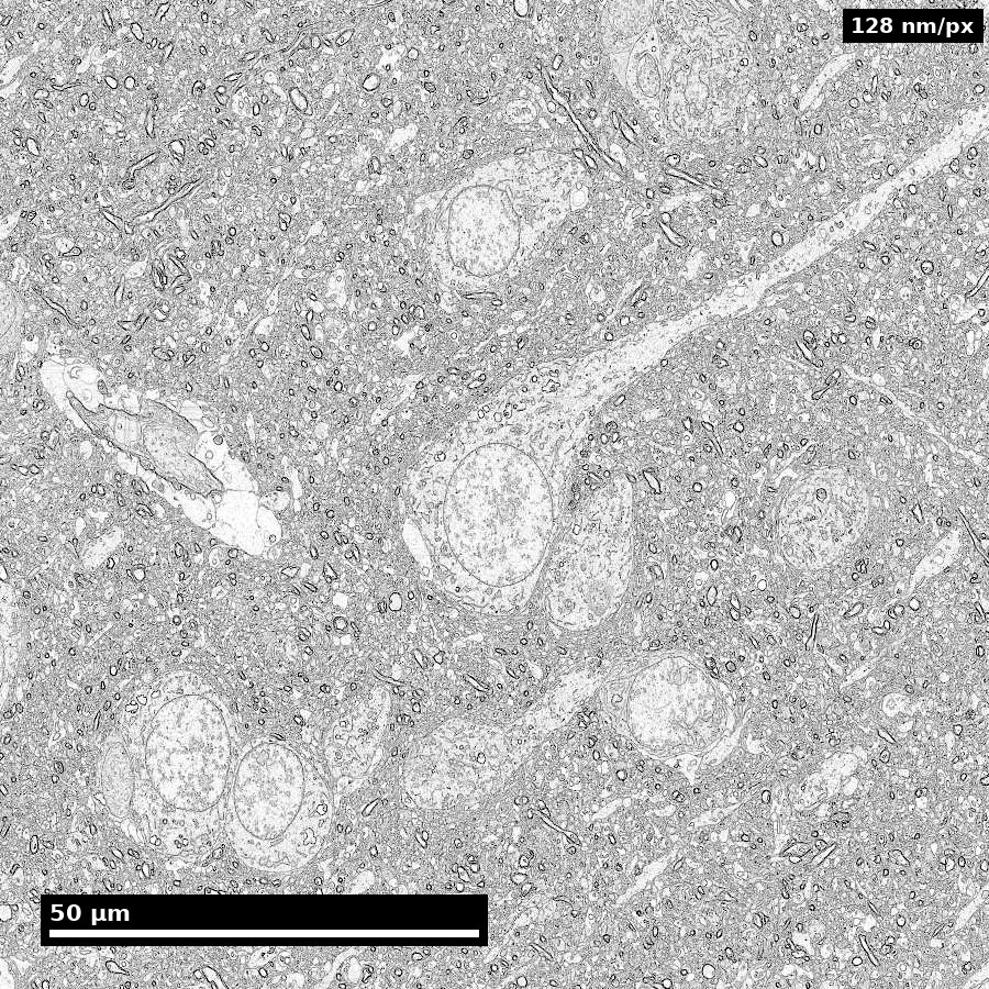 A 115-micrometre field showing cell bodies embedded in dense neuropil.