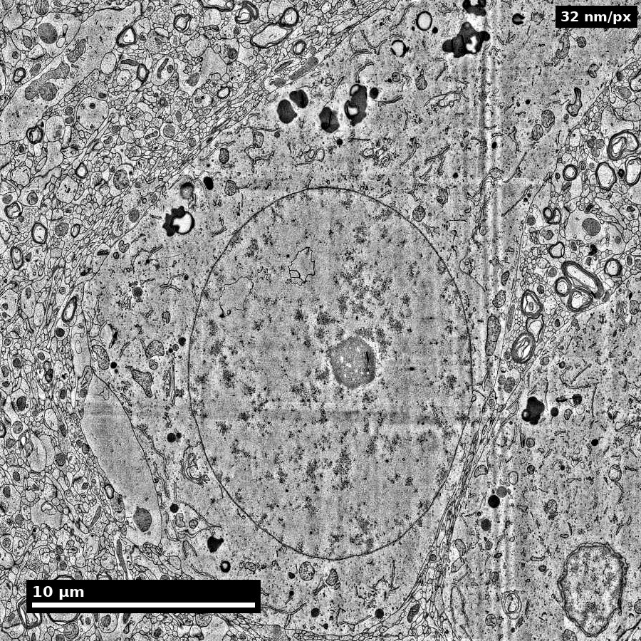 ≈29 µm — a single neuron
