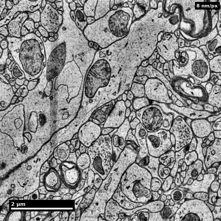 A 7-micrometre field of human cortical neuropil at 8 nanometres per pixel, showing densely packed axons, dendrites and mitochondria.