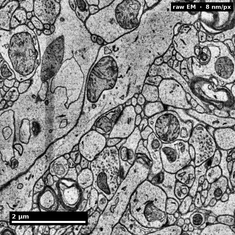 Raw electron microscopy of human cortical neuropil at 8 nanometres per pixel, greyscale.