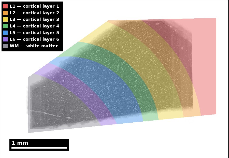 Cortical layers L1–L6 and white matter