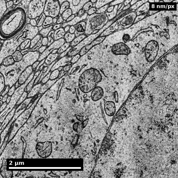 Astrocytic process