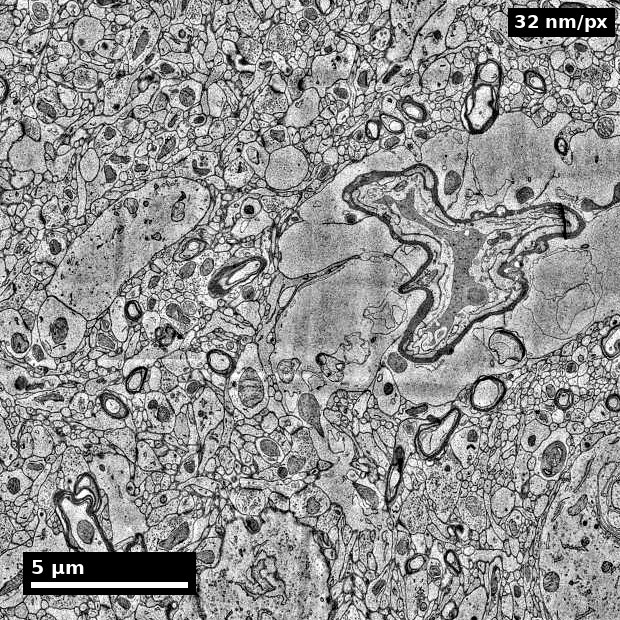 Cortical blood vessel