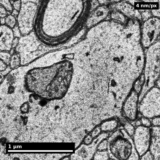 Dendrite and organelles