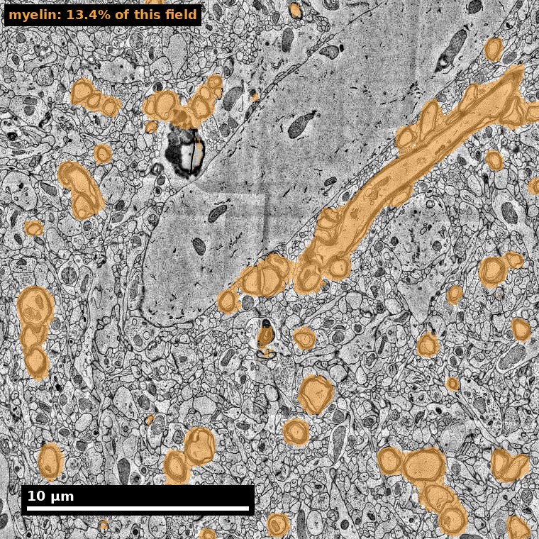 Myelin across a grey-matter field