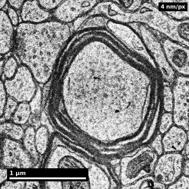 Myelinated axon