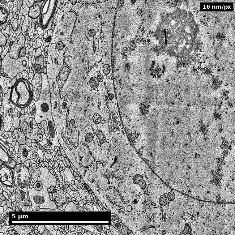 Neuronal soma