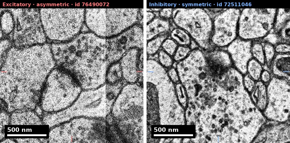 Excitatory vs inhibitory synapse