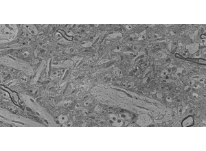 Electron micrograph of densely packed neuropil with dark ring-shaped profiles
