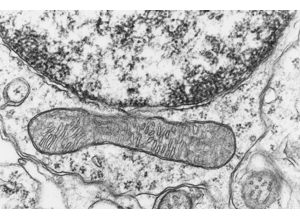 Ultrastructure training visual: dendritic context