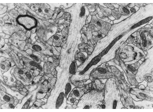 Ultrastructure training visual: synapse cues