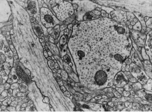 Ultrastructure training visual: vesicle and organellar detail
