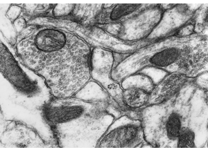 Ultrastructure training visual: comparative panel