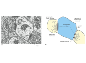 Ultrastructure training visual: ambiguity case