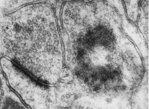 Ultrastructure training visual: advanced structural example