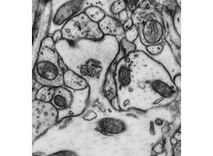 Axon/dendrite training visual: dendritic morphology cue