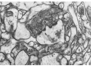 Axon/dendrite training visual: advanced cue set