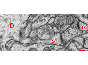 Electron micrograph of a dendrite labelled D with two spines labelled s1 and s2, each opposite a vesicle-filled bouton.