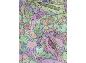 Segmentation proofreading visual: graph and pipeline transition