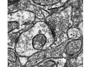 Segmentation proofreading visual: evaluation and metrics context