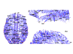 Region-level brain network drawn over the brain from above and from the side, with named cortical areas as nodes